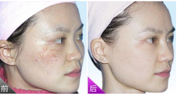 �Ͼ�����ɫ���ó�Ƥ����һ����Ч����?