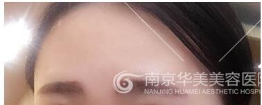 南京做纹眉有优势吗?
