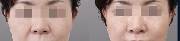 **ע���������Щ���ƣ�