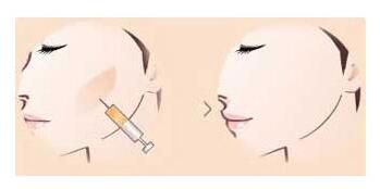 ���沿֬������ÿ���ϴ����