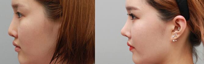 �Ͼ���ע��¡�ǻ���ȱ����