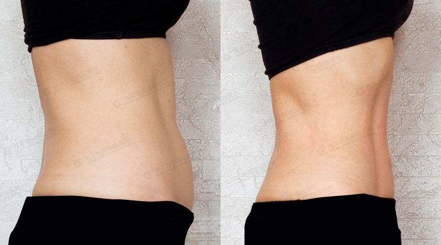 �Ͼ���������֬��������ٺ���?